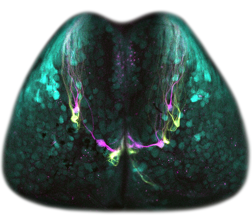 Olfactory Bulb Image